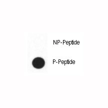Dot blot analysis of phospho-CDX2 antibody. 50ng of phos-peptide or nonphos-peptide per dot were spotted.