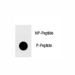 Phospho-YAP1 (Ser127) Antibody Dot Blot. Dot blot analysis demonstrates the phospho-specificity of Phospho-YAP1 (Ser127) Antibody. Fifty nanograms of phosphorylated peptide or nonphosphorylated peptide were spotted per dot and probed with the antibody. A strong signal was observed with the phospho peptide, whereas no reactivity was detected with the corresponding nonphosphorylated peptide, confirming selective recognition of YAP1 phosphorylated at serine 127. Phosphorylation of Yes Associated Protein 1 at Ser127 is a hallmark of Hippo pathway activation and promotes cytoplasmic sequestration of YAP1. These results support the utility of Phospho-YAP1 (Ser127) Antibody for monitoring Hippo pathway activity and distinguishing phosphorylated YAP1 from total protein.