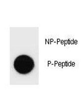 Phospho-ErbB2 (pS1107) Antibody Dot Blot Specificity. Dot blot analysis of Phospho-ErbB2 (pS1107) Antibody demonstrates strong signal for the phosphorylated peptide and no detectable binding to the corresponding non-phosphorylated peptide, confirming phospho-specific recognition of ErbB2 / HER2 at Ser1107. Approximately 50 ng of phospho-peptide or non-phospho peptide was applied per spot.