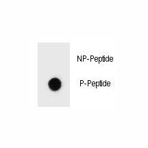 Phospho-ErbB2 (pT1172) Antibody Dot Blot Specificity. Dot blot analysis of Phospho-ErbB2 (pT1172) Antibody demonstrates strong signal for the phosphorylated peptide and no detectable binding to the corresponding non-phosphorylated peptide, confirming phospho-specific recognition of ErbB2 / HER2 at Thr1172. Approximately 50 ng of phospho-peptide or non-phospho peptide was applied per spot.