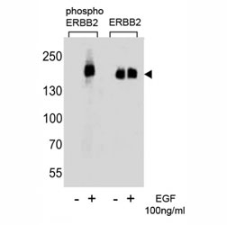 Phospho-ErbB2 (pY1127) Antibody EGF-Stimulated WB. Western blot analysis of human A431 cell lysates treated with or without EGF (100 ng/ml) using Phospho-ErbB2 (pY1127) Antibody detects a band at approximately 185 kDa in EGF-stimulated samples, consistent with the predicted molecular weight of phosphorylated ErbB2 / HER2, while untreated samples show reduced signal; parallel detection with a nonphospho ErbB2 antibody confirms total receptor expression across conditions, supporting phosphorylation-dependent signaling at Tyr1127.