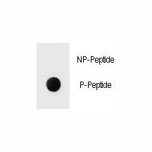 Phospho-ErbB2 (pY1139) Antibody Dot Blot Specificity. Dot blot analysis of Phospho-ErbB2 (pY1139) Antibody demonstrates strong signal for the phosphorylated peptide and no detectable binding to the corresponding non-phosphorylated peptide, confirming phospho-specific recognition of ErbB2 / HER2 at Tyr1139. Approximately 50 ng of phospho-peptide or non-phospho peptide was applied per spot.