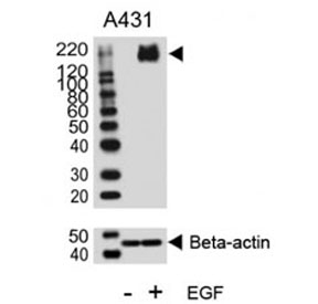 Phospho-ErbB2 (pY1140) Antibody EGF-Stimulated WB. Western blot analysis of human A431 cell lysates treated with or without EGF (100 ng/ml) using Phospho-ErbB2 (pY1140) Antibody detects a band at approximately 185 kDa in EGF-stimulated samples, consistent with the predicted molecular weight of phosphorylated ErbB2 / HER2, while untreated samples show reduced signal; beta-actin is shown as a loading control, supporting phosphorylation-dependent signaling at Tyr1140.