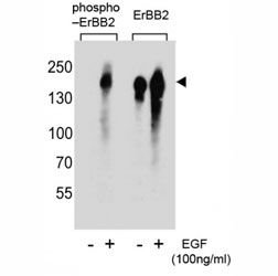 Phospho-ErbB2 (pY1005) Antibody EGF-Stimulated WB. Western blot analysis of human A431 cell lysates treated with or without EGF (100 ng/ml) using Phospho-ErbB2 (pY1005) Antibody detects a band at approximately 185 kDa in EGF-stimulated samples, consistent with the predicted molecular weight of phosphorylated ErbB2 / HER2, while untreated samples show reduced signal; parallel detection with a nonphospho ErbB2 antibody confirms total receptor expression across conditions, supporting phosphorylation-dependent early signaling at Tyr1005.
