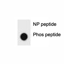 Phospho-ErbB2 (pY1005) Antibody Dot Blot Specificity. Dot blot analysis of Phospho-ErbB2 (pY1005) Antibody demonstrates strong signal for the phosphorylated peptide and no detectable binding to the corresponding non-phosphorylated peptide, confirming phospho-specific recognition of ErbB2 / HER2 at Tyr1005. Approximately 50 ng of phospho-peptide or non-phospho peptide was applied per spot.