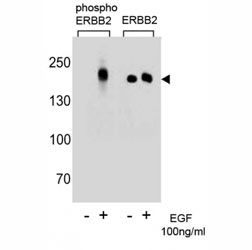 Phospho-ErbB2 (pY1196) Antibody EGF-Stimulated WB. Western blot analysis of human A431 cell lysates treated with or without EGF (100 ng/ml) using Phospho-ErbB2 (pY1196) Antibody detects a band at approximately 185 kDa in EGF-stimulated samples, consistent with the predicted molecular weight of phosphorylated ErbB2 / HER2, while untreated samples show reduced signal; parallel detection with a nonphospho ErbB2 antibody confirms total receptor expression across conditions, supporting phosphorylation-dependent signal maintenance at Tyr1196.