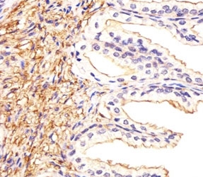 Immunohistochemical analysis of paraffin-embedded human prostate section using ATF6 beta antibody at 1:25.