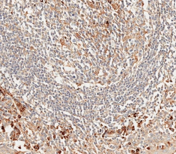 IHC testing of FFPE human tonsil tissue with CD63 antibody. HIER: steam tissue sections in 10mM citrate buffer, pH 6, for 10-20 min followed by cooling at RT for 20 min.