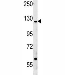 Western blot testing of human MCF7 cell lysate with CUX1 antibody at 1:2000. Expected molecular weight ~200 kDa with smaller isoforms.
