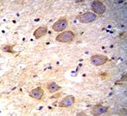 cIAP2 antibody immunohistochemistry analysis in formalin fixed and paraffin embedded human brain tissue.