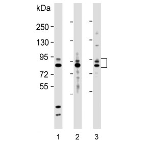 Western blot testing of human 1) NCI-H1299, 2) HL60 and 3) A431 cell lysate with MMP9 antibody. Predicted molecular weight: 92/67-80 kDa (precursor/mature forms).