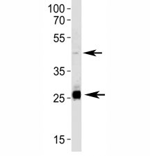 SIRT3 Antibody HepG2 Cell WB. SIRT3 antibody western blot analysis in HepG2 lysate. Predicted size: 44/28 kDa (full/processed)