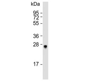 Western blot analysis of SIRT3 antibody and mouse liver lysate