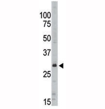 Western blot analysis of SIRT5 antibody in Jurkat lysate