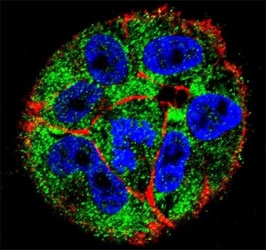Confocal immunofluorescent analysis of p53 antibody with A2058 cells followed by Alexa Fluor 488-conjugated goat anti-rabbit lgG (green). Actin filaments have been labeled with Alexa Fluor 555 Phalloidin (red). DAPI was used as a nuclear counterstain (blue).