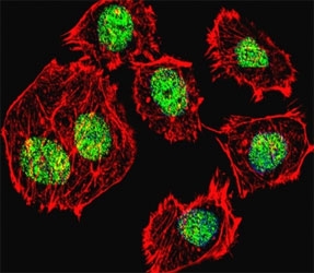 TP53 Antibody for Immunofluorescence / Tumor Protein p53 IF Antibody. Immunofluorescence analysis of human U251 glioma cells using TP53 Antibody for Immunofluorescence / Tumor Protein p53 IF Antibody shows strong nuclear localization of p53 (green). Cytoskeletal actin filaments are visualized with a red fluorescent counterstain, highlighting cellular morphology, while nuclei display concentrated p53 fluorescence consistent with transcription factor accumulation in the nucleus. The image was acquired using confocal fluorescence microscopy, demonstrating nuclear enrichment of Tumor protein p53 within human glioma cells.