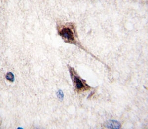 IHC analysis of FFPE human brain tissue stained with MEF2C antibody