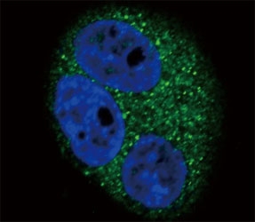 Confocal immunofluorescent analysis of CD14 antibody with A549 cells followed by Alexa Fluor 488-conjugated goat anti-rabbit lgG (green). DAPI was used as a nuclear counterstain (blue).