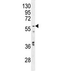 Glypican 3 antibody western blot analysis in mouse stomach tissue lysate