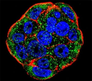 Confocal immunofluorescent analysis of FGF1 antibody with WiDr cells followed by Alexa Fluor 488-conjugated goat anti-rabbit lgG (green). Actin filaments have been labeled with Alexa Fluor 555 Phalloidin (red). DAPI was used as a nuclear counterstain (blue).