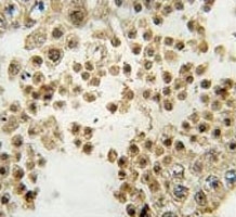 PRKN Antibody Human Testis IHC. IHC staining of FFPE human testis tissue was performed with PRKN Antibody. Positive PRKN/Parkin staining is observed in cells within the seminiferous tubules, with predominantly cytoplasmic signal. This PRKN Antibody demonstrates localization of Parkin RBR E3 ubiquitin ligase in human testis tissue.