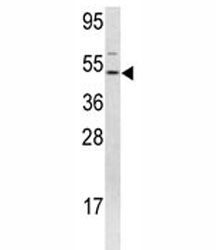 FLI1 Antibody HEK293 WB. Western blot analysis of FLI1 antibody and 293 lysate.