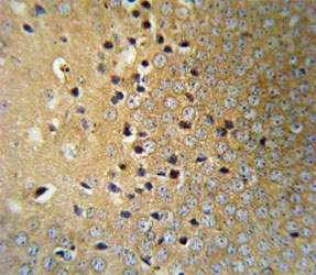 VHL Antibody Mouse Brain IHC. Immunohistochemistry staining of FFPE mouse brain tissue using VHL antibody demonstrates widespread cytoplasmic staining throughout neuronal populations, consistent with expression of Von Hippel-Lindau protein (VHL). VHL is a tumor suppressor protein that regulates hypoxia-inducible factor (HIF) signaling and plays a central role in cellular oxygen sensing, metabolic adaptation, and maintenance of cellular homeostasis. The observed staining pattern is consistent with the established role of VHL in regulating oxygen-responsive pathways within metabolically active neural tissues. These findings support the utility of VHL antibody for studies of hypoxia signaling, HIF regulation, and tumor suppressor-associated cellular pathways in the nervous system.