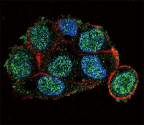 VHL Antibody HepG2 Cell IF. Immunofluorescent staining of HepG2 cells using VHL antibody demonstrates punctate cytoplasmic and perinuclear localization of Von Hippel-Lindau protein (VHL), shown in green. VHL is a tumor suppressor protein that regulates hypoxia-inducible factor (HIF) signaling and serves as a critical component of cellular oxygen-sensing pathways. The observed intracellular distribution is consistent with the role of VHL in protein degradation complexes and regulation of hypoxia-responsive signaling networks. Actin filaments are visualized with Alexa Fluor 555 Phalloidin (red), while DAPI (blue) identifies cell nuclei. The staining pattern supports the utility of VHL antibody for studies of tumor suppression, hypoxia signaling, and oxygen homeostasis pathways.
