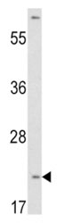 VHL Antibody HepG2 WB. Western blot analysis of HepG2 cell lysate using VHL antibody demonstrates detection of an immunoreactive band at approximately 18-20 kDa, consistent with the expected molecular weight of Von Hippel-Lindau protein (VHL). VHL is a tumor suppressor protein that functions as a key regulator of hypoxia-inducible factor (HIF) signaling and cellular oxygen-sensing pathways. Through its role in an E3 ubiquitin ligase complex, VHL controls degradation of HIF proteins and helps maintain normal cellular responses to oxygen availability. The observed band supports the utility of this antibody for studies of tumor suppression, hypoxia signaling, oxygen homeostasis, and HIF-regulated cellular pathways. Predicted molecular weight: ~18-24 kDa.
