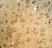 VHL antibody IHC analysis in formalin fixed and paraffin embedded mouse brain tissue.