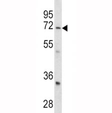 Western blot analysis of GARP antibody and mouse cerebellum tissue lysate