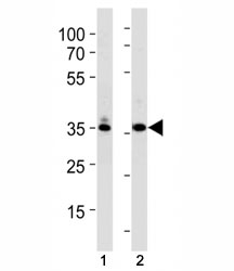 TBP / TATA Binding Protein antibody western blot analysis in (1) K562 and (2) U251 lysate. Observed molecular weight: 35-43 kDa.