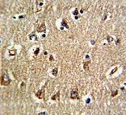 IHC analysis of FFPE human brain tissue stained with RAN antibody