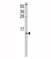Western blot analysis of CCL2 antibody and HeLa lysate. Predicted molecular weight ~11/9kDa (precursor/mature).