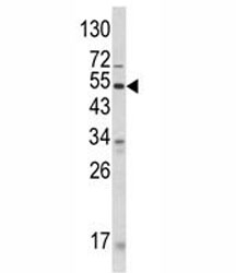 Western blot analysis of ANGPTL3 antibody and human CEM lysate. Expected molecular weight 50 ~ 63 kDa depending on glycosylation level.