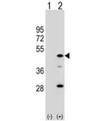 Western blot analysis of AADAC antibody and 293 cell lysate either nontransfected (Lane 1) or transiently transfected (2) with the AADAC gene.