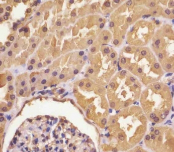 IHC testing of FFPE human kidney with ASS1 antibody at 1:25 dilution. HIER: boil tissue sections in pH6, 10mM citrate buffer, for 10-20 min followed by cooling at RT for 20 min.