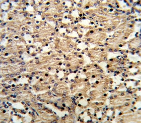 PAX8 Antibody / Differentiated vs Dedifferentiated Tumor Marker Antibody immunohistochemistry in mouse kidney tissue showing predominantly cytoplasmic HRP-DAB brown staining with scattered nuclear positivity in renal tubular epithelial cells. Paired box protein Pax-8 (PAX8) is primarily a nuclear transcription factor, and the presence of cytoplasmic staining may reflect altered localization, isoform-specific distribution, or tissue-specific processing in this sample. Tubular epithelial structures are clearly highlighted, while surrounding stromal elements remain comparatively weak or negative. The mixed cytoplasmic and nuclear pattern provides context for interpreting differentiation status, as changes in subcellular localization can be associated with altered transcriptional activity or cellular state.