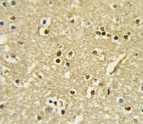IHC analysis of FFPE human brain tissue stained with PAX6 antibody