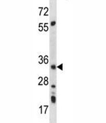 AMPK beta 2 antibody western blot analysis in mouse kidney tissue lysate