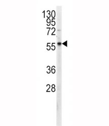 Western blot analysis of PKM2 antibody and CEM lysate. Predicted molecular weight ~58 KDa.