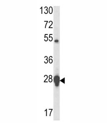 Western blot analysis of HSP27 antibody and MCF-7 lysate