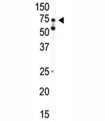 Western blot analysis of AMPK alpha 2 antibody and mouse heart tissue lysate