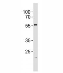Western blot analysis of lysate from A431 cell line using SPHK1 antibody at 1:1000. Predicted molecular weight: ~43/51/44kDa (isoforms 1/2/3).