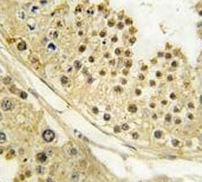 IHC analysis of FFPE human testis tissue stained with Aurora B antibody