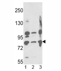 Western blot analysis of Neprilysin antibody and 1) A2058, 2) A375, 3) Ramos lysate.