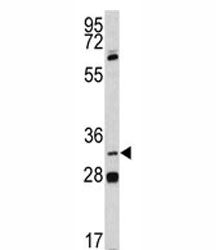 PITX1 Antibody Human Lung Cancer Cell WB. Western blot testing of human NCI-H460 cell lysate with PITX1 Antibody. A specific band was detected at approximately 34 kDa, consistent with the predicted molecular weight of PITX1. PITX1 Antibody / Developmental Transcription Factor Antibody supports detection of pituitary homeobox 1 expression and studies of homeobox transcription factors, developmental gene regulation, cellular differentiation and cancer biology pathways.