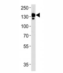 Ceruloplasmin Antibody Human Plasma WB. Western blot analysis of human blood plasma lysate using Ceruloplasmin Antibody / Plasma Copper-Binding Protein Antibody demonstrates a strong band at approximately 130 kDa, consistent with the expected molecular weight of mature Ceruloplasmin (CP). Ceruloplasmin is the principal copper-carrying glycoprotein in plasma and plays a central role in systemic copper transport, iron metabolism, and maintenance of metal ion homeostasis. Synthesized primarily by the liver and secreted into circulation, Ceruloplasmin functions as a multicopper ferroxidase that oxidizes ferrous iron to ferric iron, facilitating iron loading onto transferrin and supporting efficient iron transport throughout the body. The prominent plasma-associated signal is consistent with the abundant circulating expression of Ceruloplasmin and its established role in mineral transport, metabolic regulation, and physiologic homeostasis.