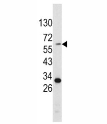 Western blot analysis of Tyrosinase antibody and HepG2 lysate.