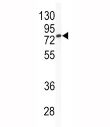 Western blot analysis of BCL6 antibody and mouse cerebellum tissue lysate. Predicted molecular weight: 78~100 kDa.